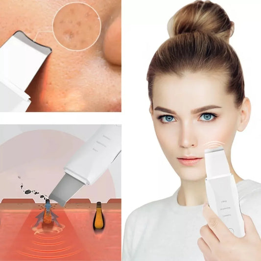 Espatula Peeling Ultrasonico Limpiador Facial Lifting